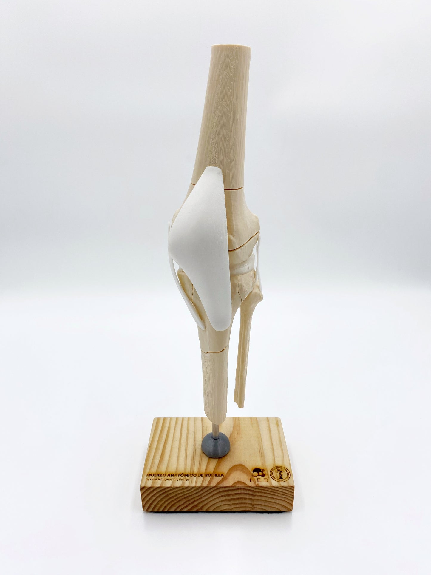 Modelo de Rodilla Fracturas