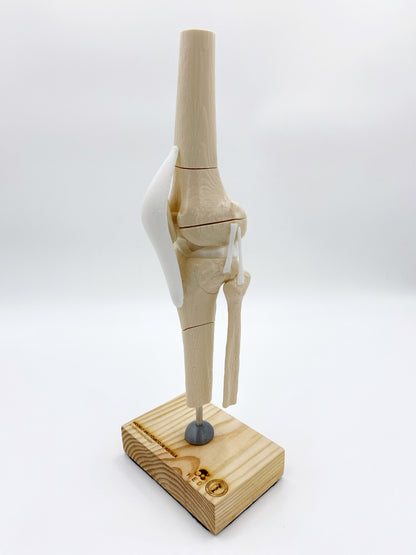 Modelo de Rodilla Fracturas