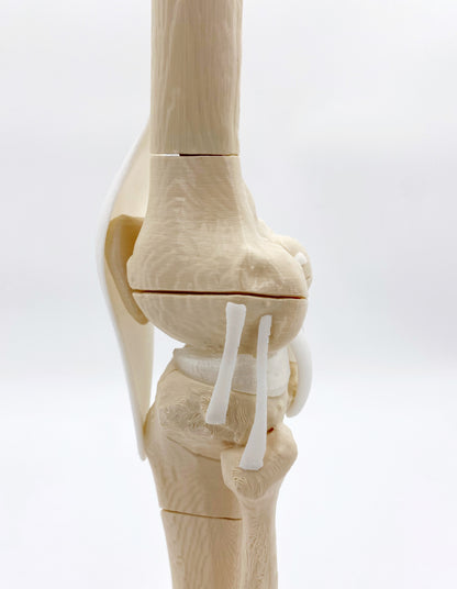 Modelo de Rodilla Fracturas