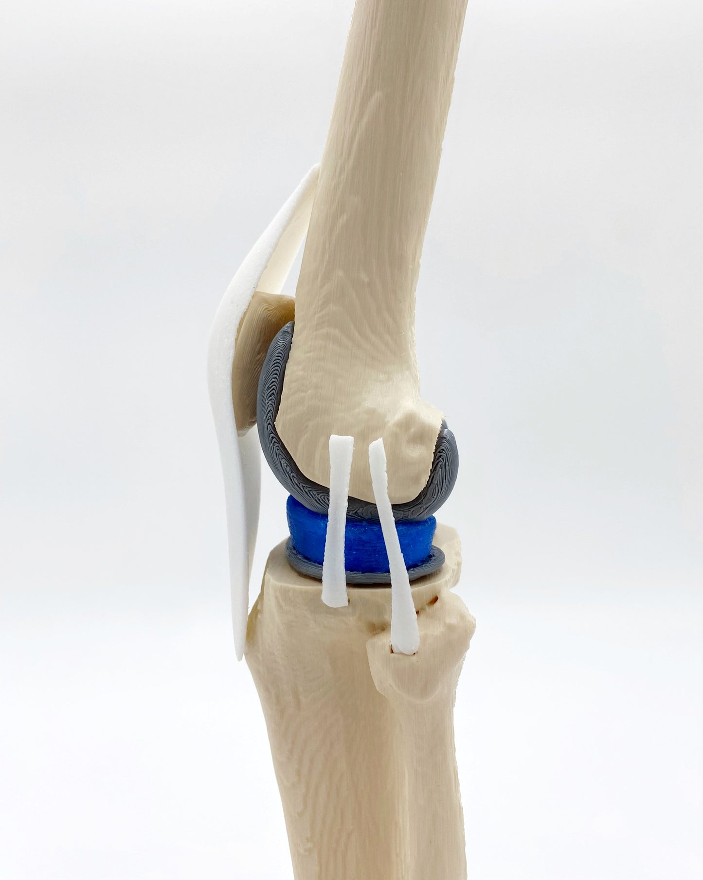 Modelo de Rodilla Implante